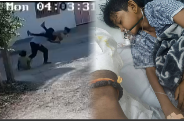 बलिया: दबंग ने 8 साल के बच्चे को 7 फीट ऊपर उठाया और सड़क पर बेदर्दी से पटक दिया, बच्चे की हालत नाजुक