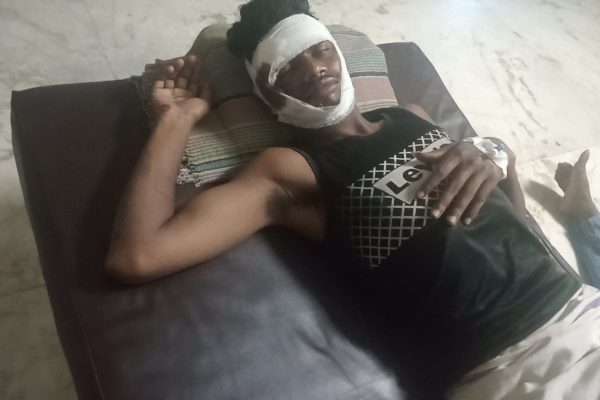 दर्दनाक सड़क हादसा: दो बाइकों की आमने-सामने भिड़ंत में युवक गंभीर घायल, आरोपी बाइक सवार मौके से फरार