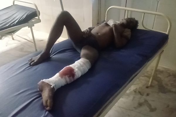 मझौली में भीषण सड़क हादसा: ऑटो ने मारी बाइक को टक्कर, दो युवक गंभीर घायल, एक-एक पैर टूटा, सिर में आई गंभीर चोट