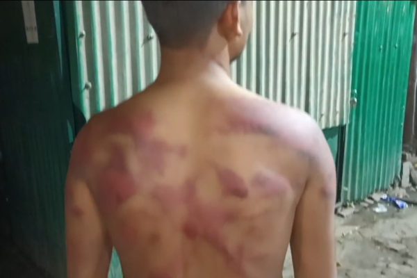 हरदोई: प्रेमिका के घर मिलने पहुंचे प्रेमी को पिलाई यूरीन, नंगे बदन गरम पानी डालकर पीटा, बंधक बनाकर की हैवानियत