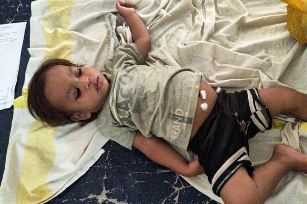 Bihar: बेतिया में 1 साल के मासूम ने किया चौंकाने वाला कारनामा, जहरीले कोबरा को दांतों से काटकर मार डाला